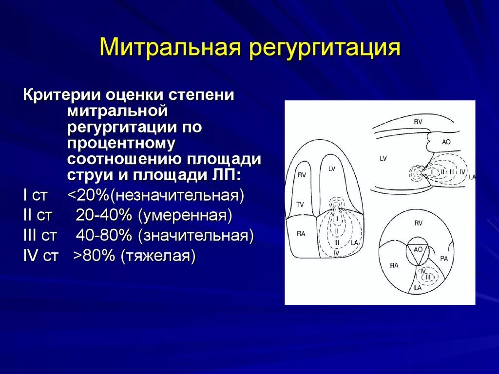 Тк регургитация 1. Степени регургитации митрального клапана по УЗИ. Регургитация митрального клапана 1-2. Регургитация на ЭХОКГ. Две струи регургитации митрального клапана.