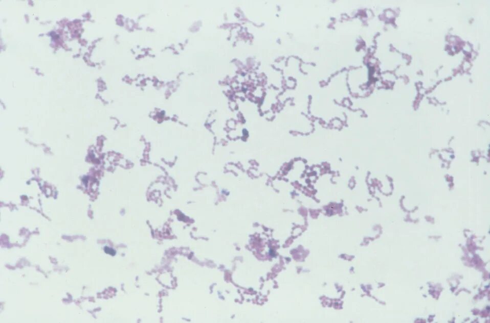 Peptostreptococcus. Peptostreptococcus anaerobius. Peptostreptococcus микробиология. Пептострептококки микробиология. Peptostreptococcus anaerobius 18623.