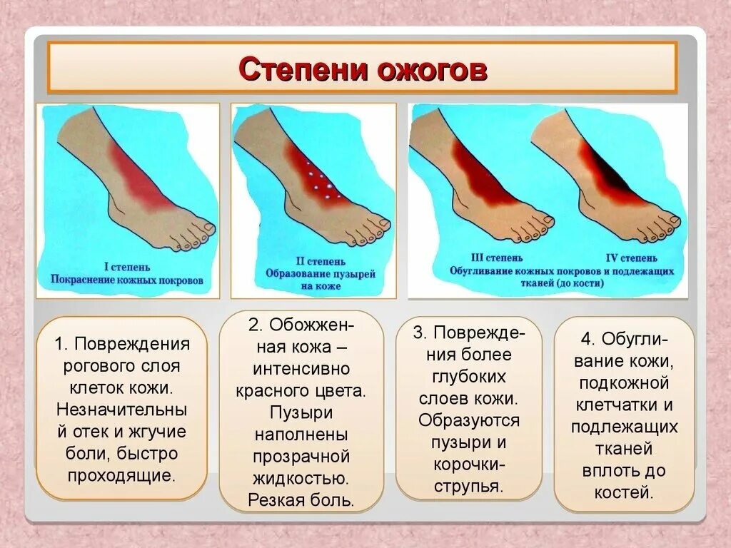 Ожоги 1 степень 2 степень 3 степень 4 степень. Ожоги 3 степени тяжести термических. Заболевания и повреждения кожи