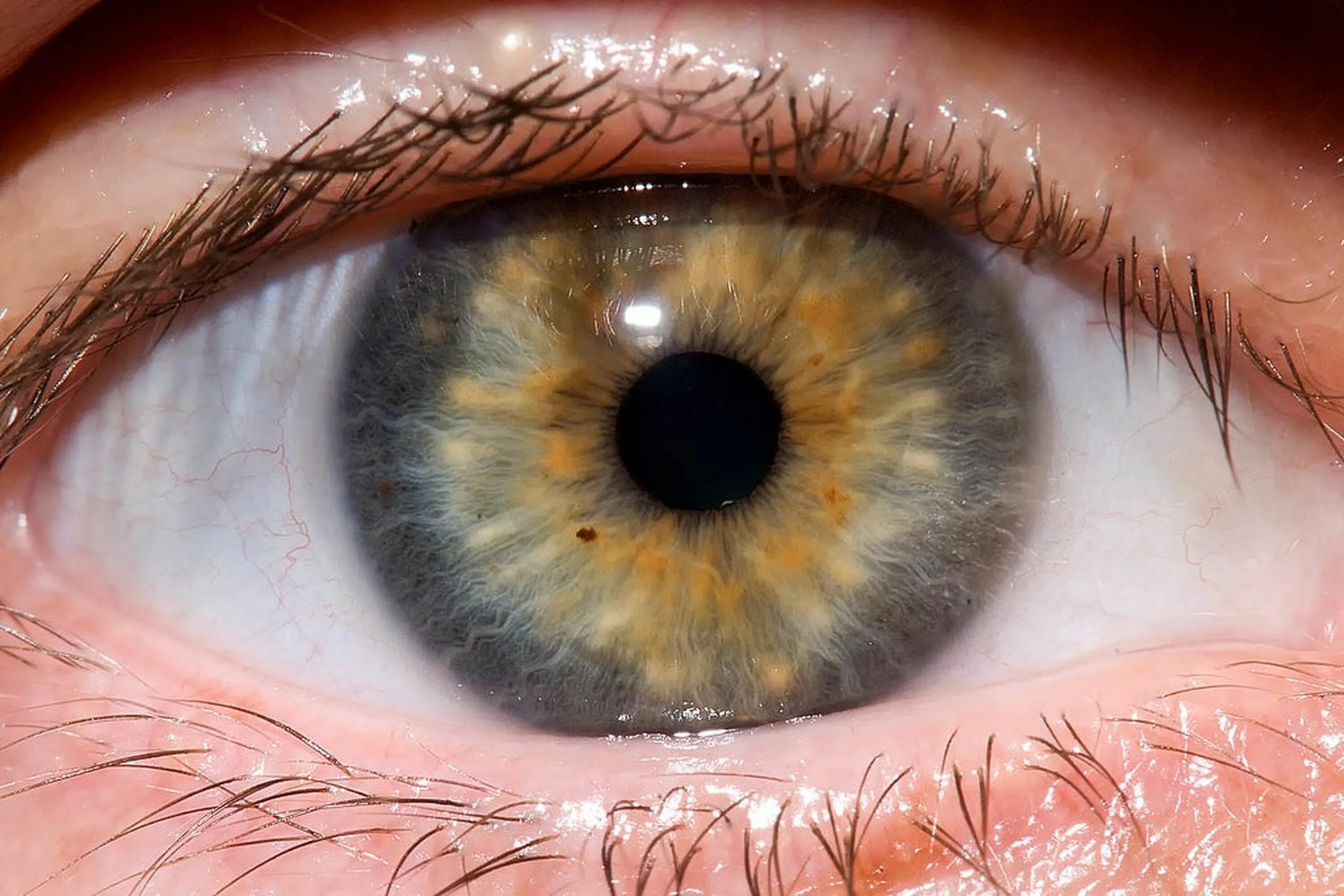 Глаукома Франк Каменецкого. Красивые глаза. Глаз человека. Здоровый глаз человека. Темная радужка глаза