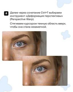 Как избавиться от синих кругов под глазами
