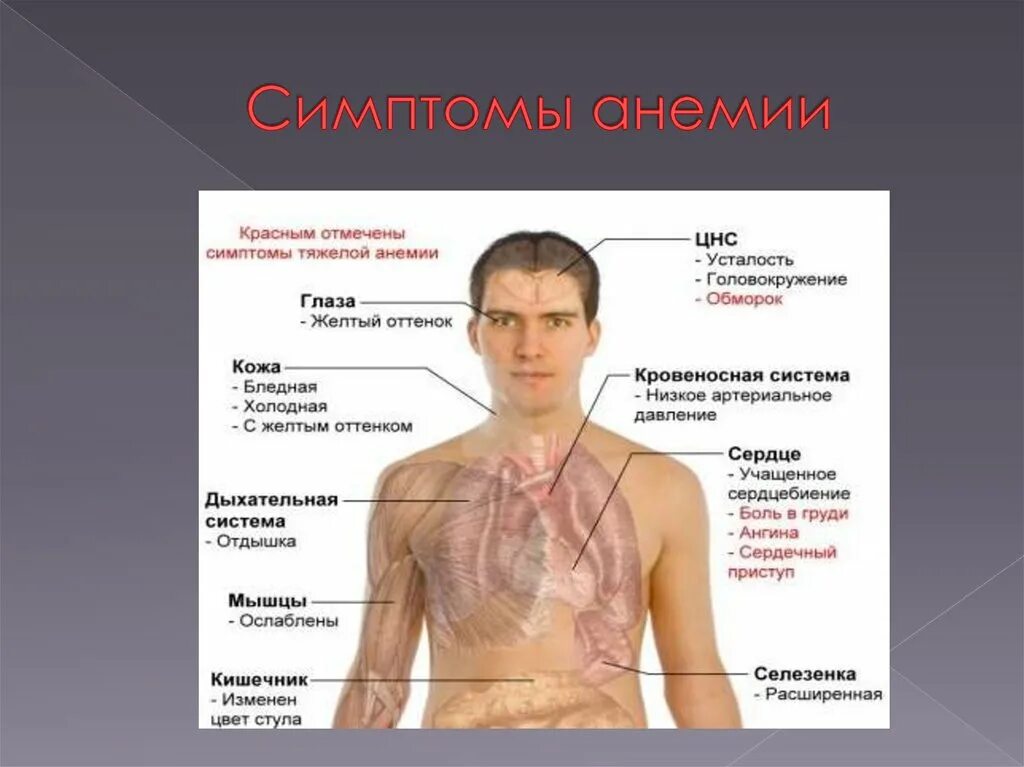 Анемия симптомы заболевания. Внешние проявления анемии. Признаки проявления анемии.