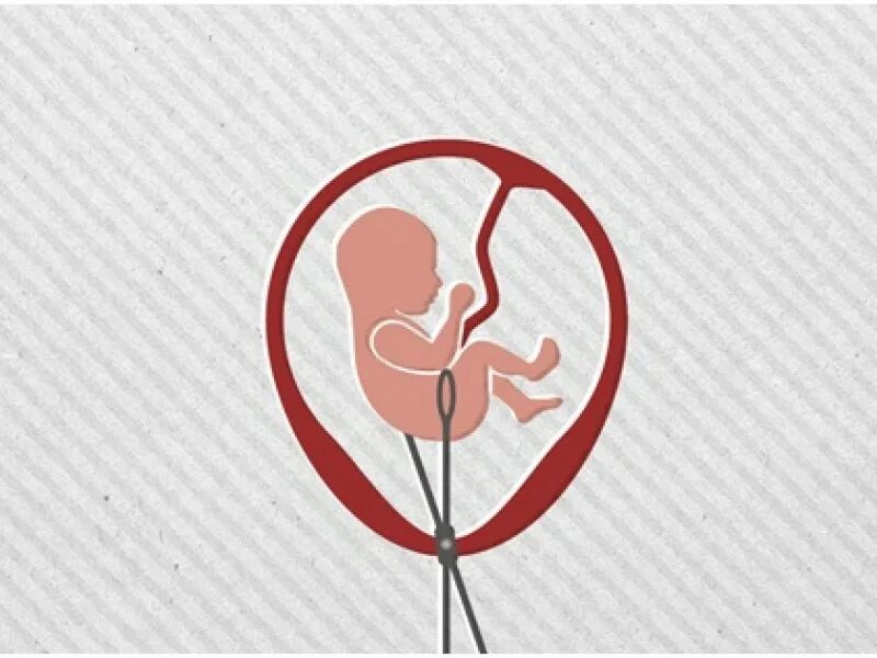 Запрет прерываний в коде. Прервано запрещено. Запрет прерываний в коде. Регистр запросов прерывания. Мероприятия которые запрещено прерывать рекламой.