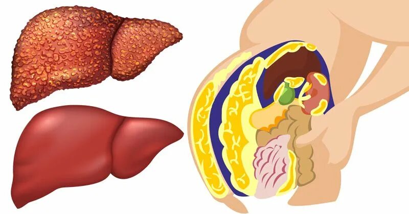 Как выглядит печень внутри Human liver, illustration Stock Image F015/8996 Science Photo Library