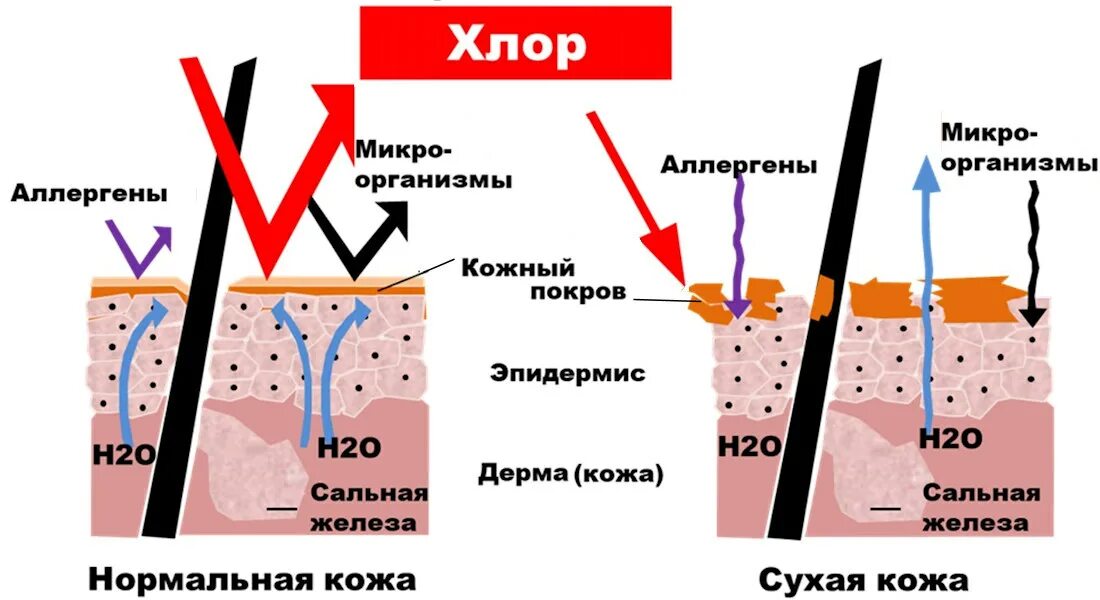 Как влияет горячая вода. Хлор воздействие на кожу. Хлор как действует на организм. Воздействие хлорки на кожу.