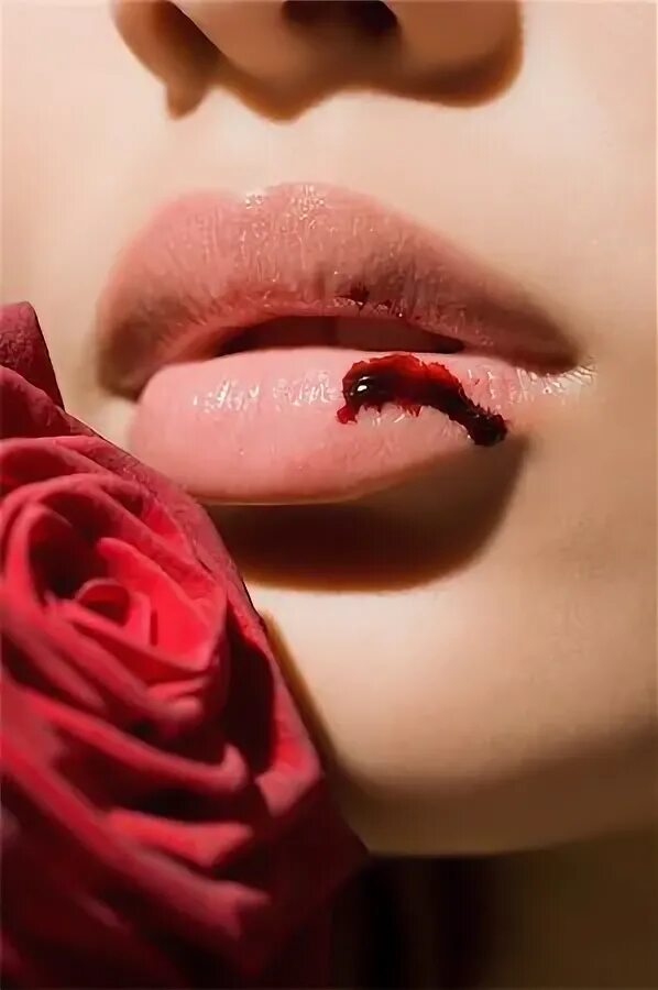 Broken lips