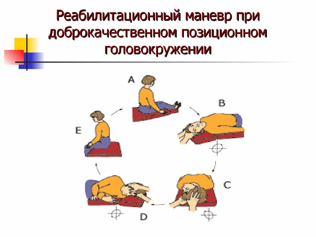 Позиционные маневры Эпли. Маневры Эпли при головокружении. Упражнения при доброкачественном позиционном головокружении. Вестибулярная гимнастика маневр Эпли.