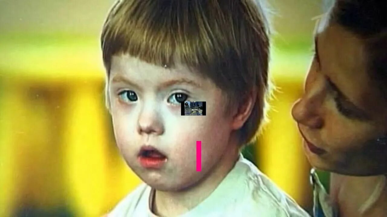 Человек страдающий аутизмом. Лицо дауна. Мальчик с аутизмом. Дети с рда. Люди страдающие аутизмом.