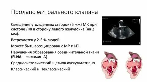 Пролапс задней стенки