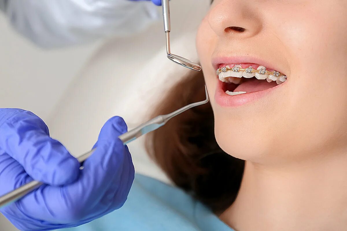 Стоматолог ортодонт. Ортодонтия в стоматологии. Консультация стоматолога ортодонта. Стоматологические брекеты.