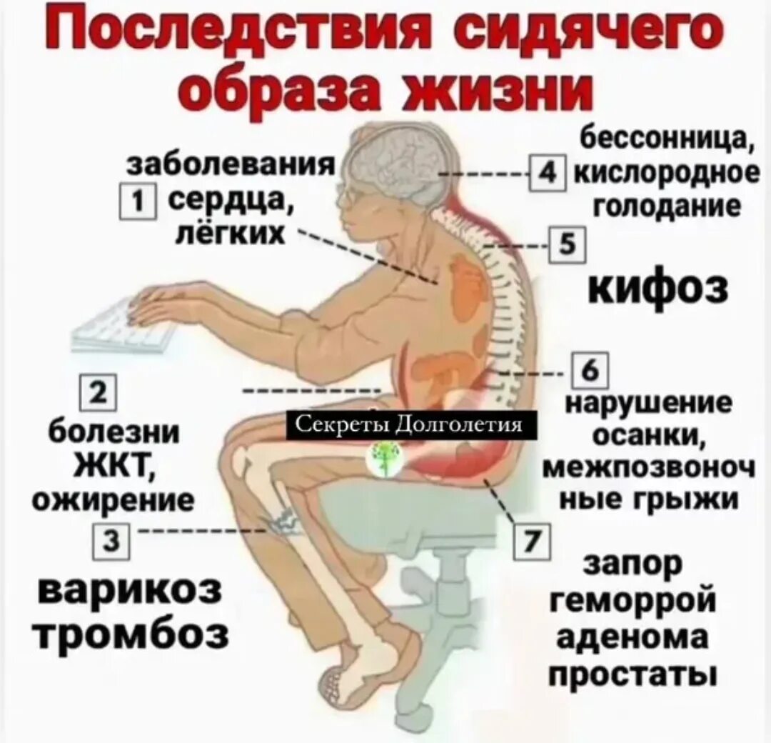 Ведете сидячий образ жизни. Сидячий образ жизни последствия. Последствия малоподвижного образа жизни. Болезни сидячего образа жизни. Малоподвижный образ жизни.