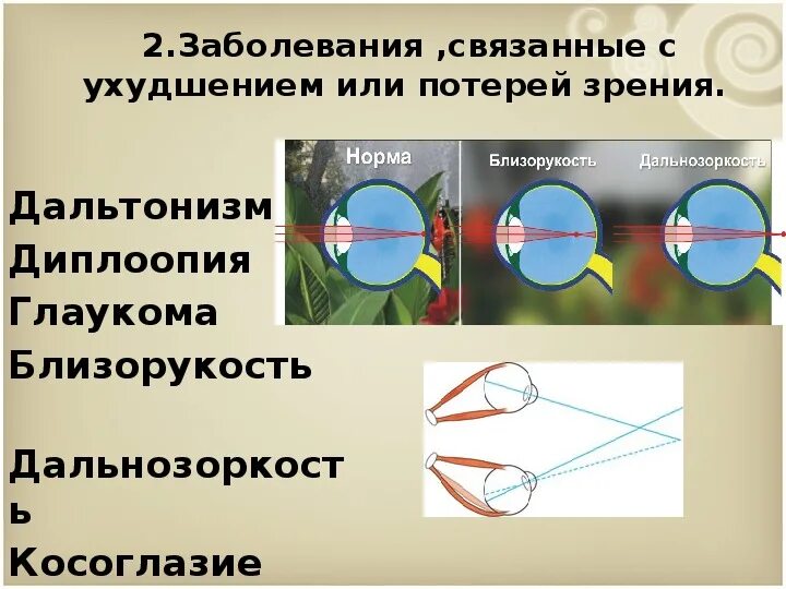 Глаз очки дальнозоркость и близорукость. Близорукость с точки зрения физики. Дальтонизм близорукость дальнозоркость. Линзы с точки зрения физики. Близорукость с точки физики.