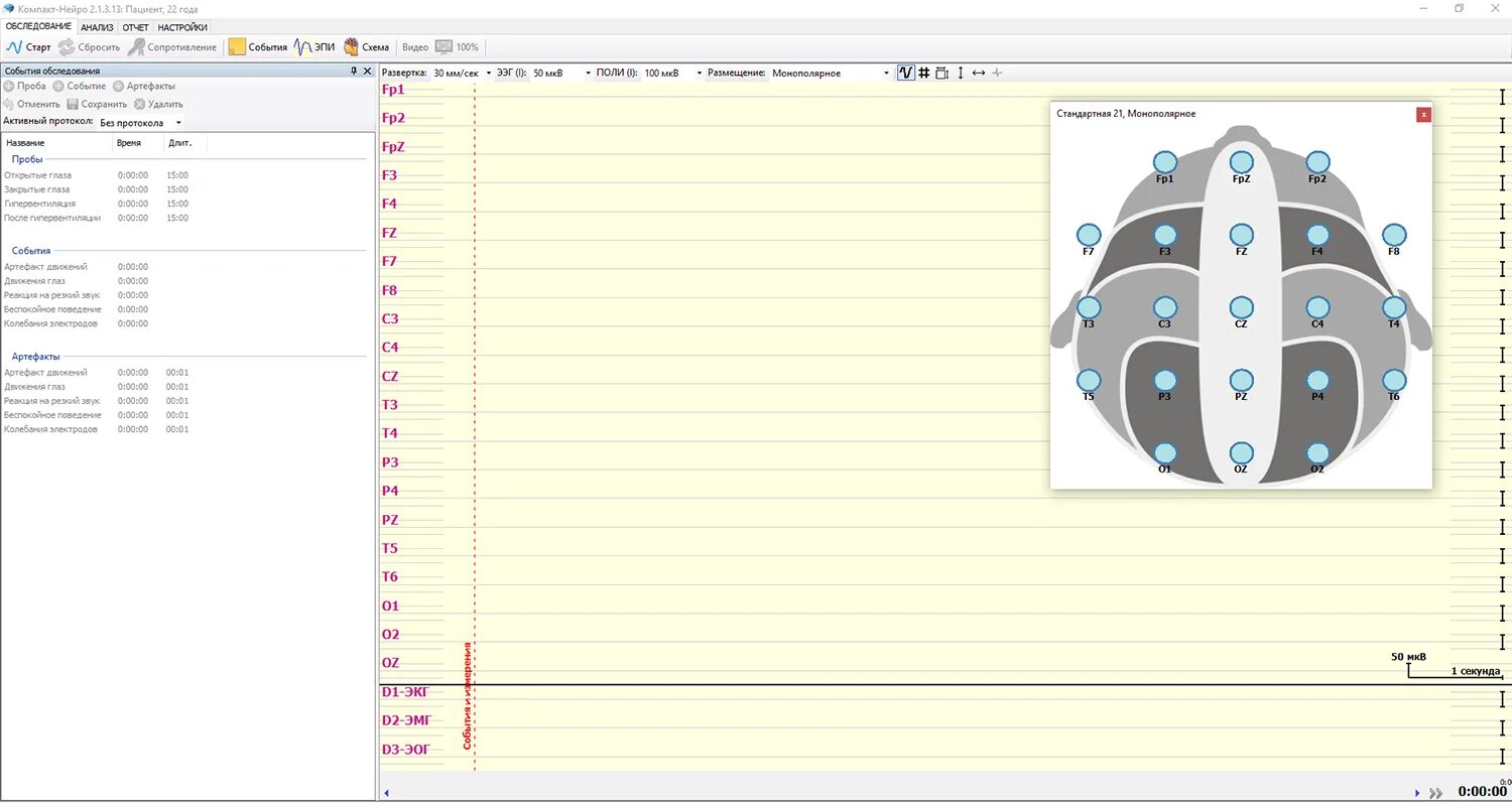 Что такое нейро. Компакт-Нейро 16-канальный. 16 Канальный ЭЭГ Нейротех. ЭЭГ-аппарат «компакт-Нейро» 21-канальный. ЭЭГ компакт Нейро.