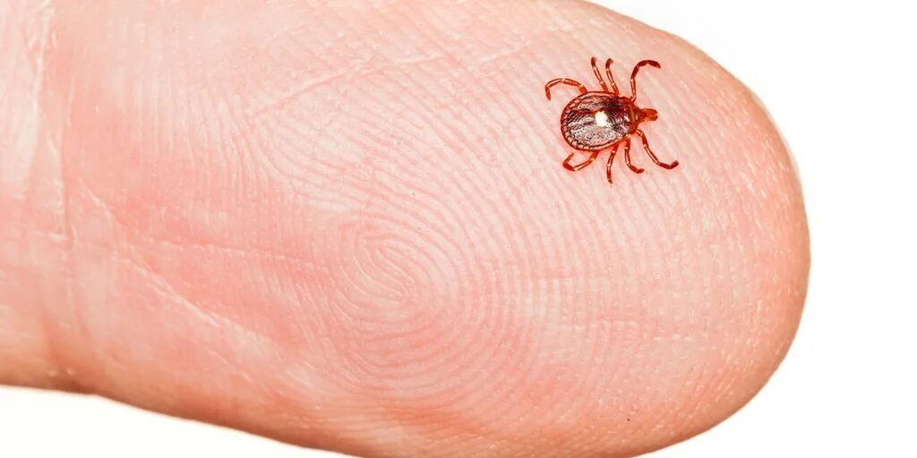 Baby ticks. Baby ticks. Клещ энцефалитный черный. Укус боррелиозного клеща. Baby ticks.