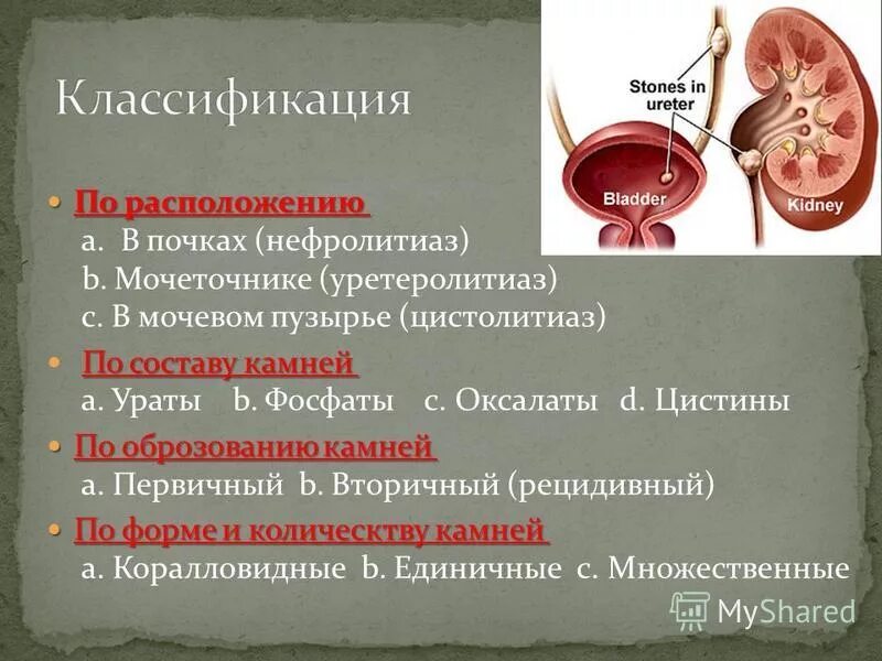 Заболевания мочевыделительной системы мочекаменная болезнь. Мочекаменная болезнь (нефролитиаз). Классификация конкрементов почек. Образование камней в мочевыделительной системе.