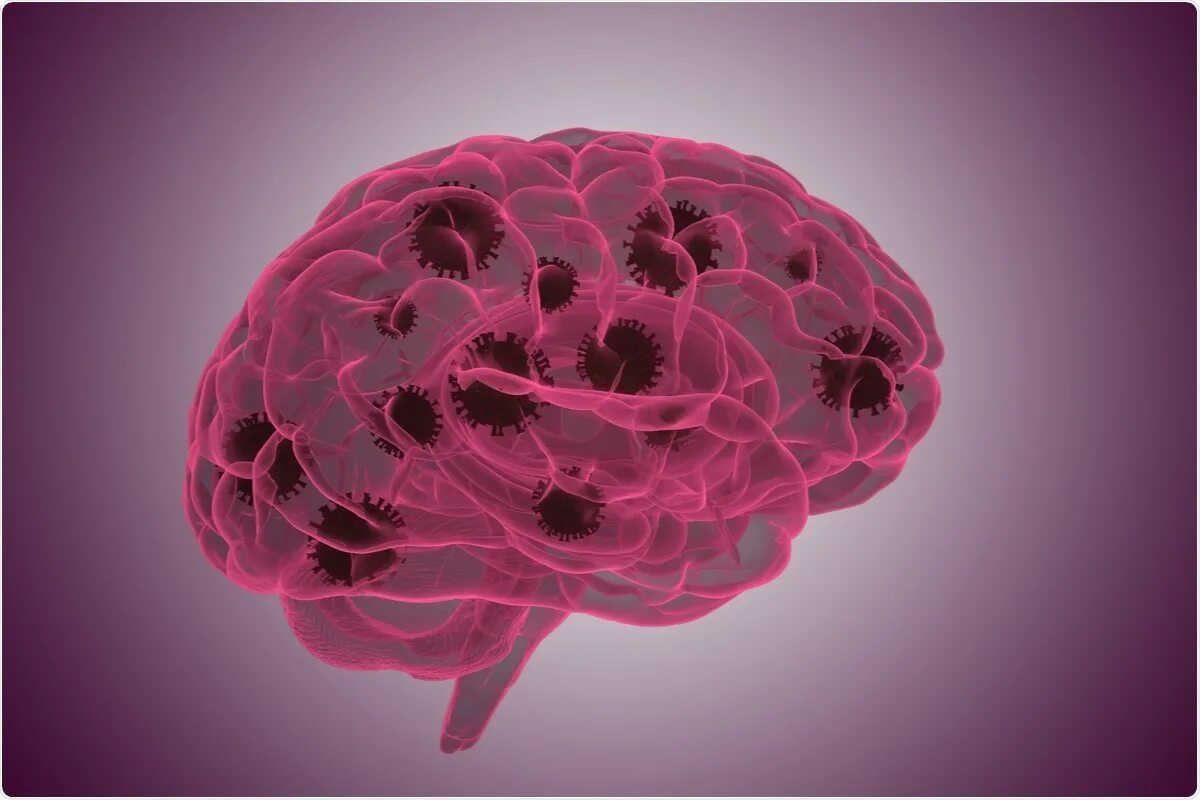 Brain 2 12. Covid 19 molecule. Covid 19 Neurology findings.