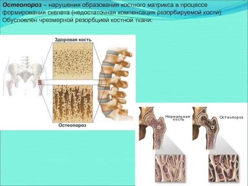 Формирование скелета растения ткань