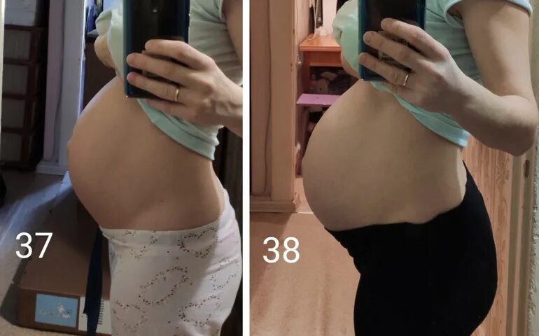 Живот на 38 неделе беременности. Живот на 37 неделе беременности. 37 Недель живот каменеет. Каменеет живот при беременности. Ноет живот 38 неделя