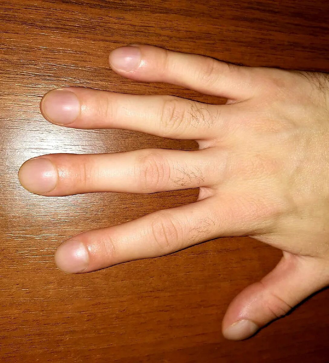 Как должны выглядеть пальцы рук Our hands are amazing. We communicate, forge relationships, pick and prepare foo
