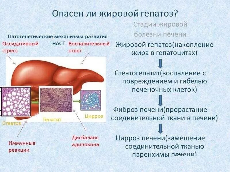 Плотный проведение. Жировой гепатоз печени 1 стадия. Жировой гепатоз развивается при. Печень при жировом гепатозе. Жировой гипотенуз печени.