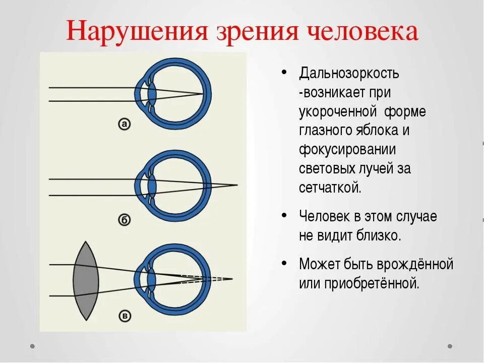 Нарушение зрения относится к