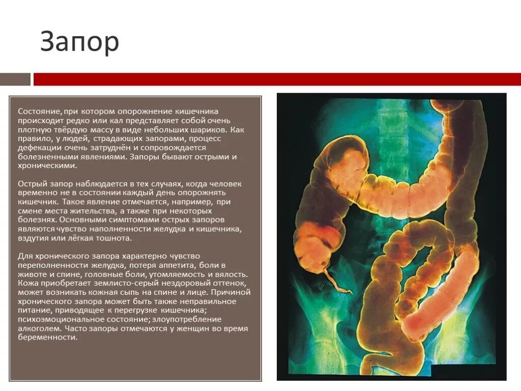 Недельный запор. Процесс дефекация у детей. Кишечник человека при запоре.