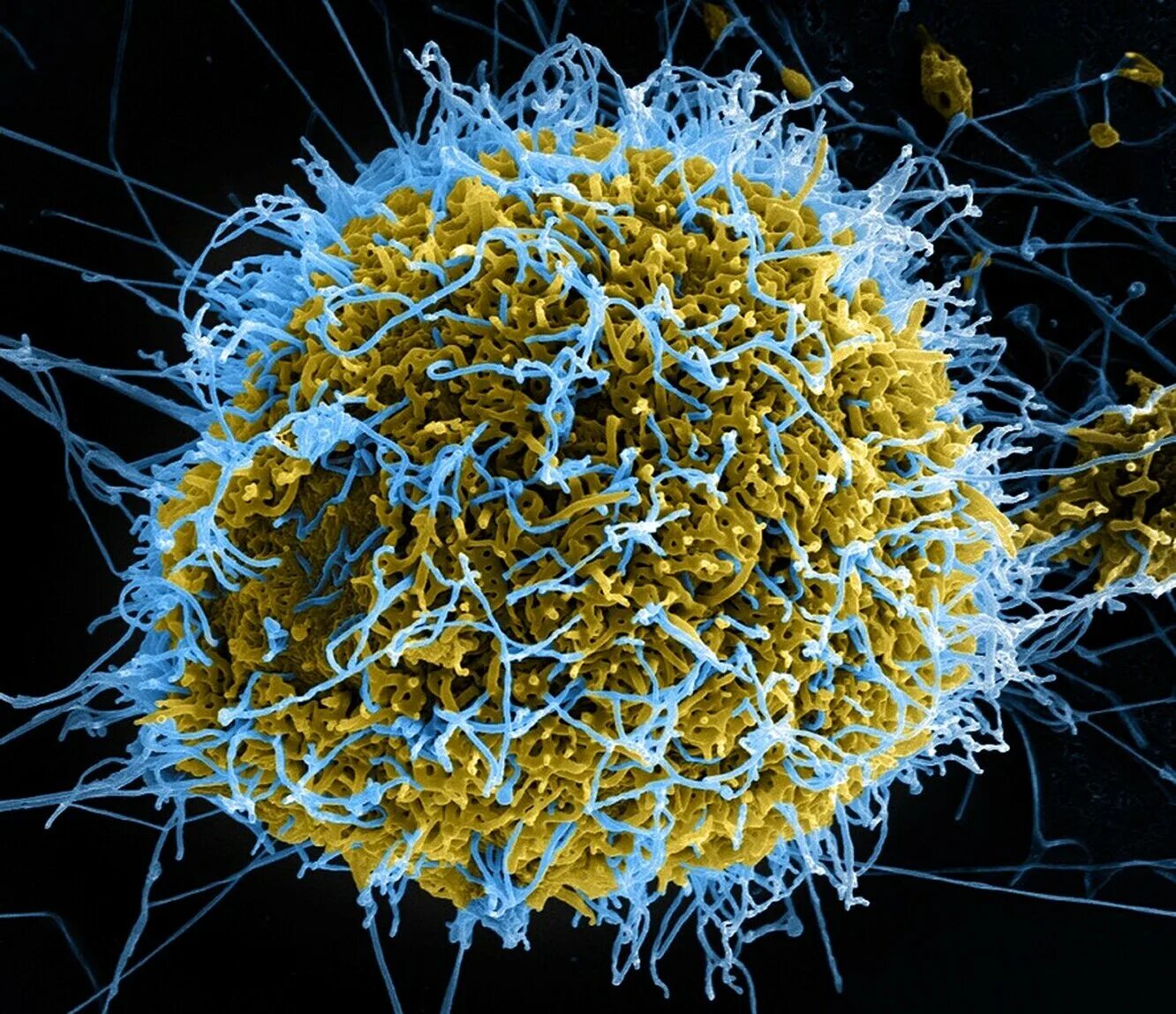 Virus neshta