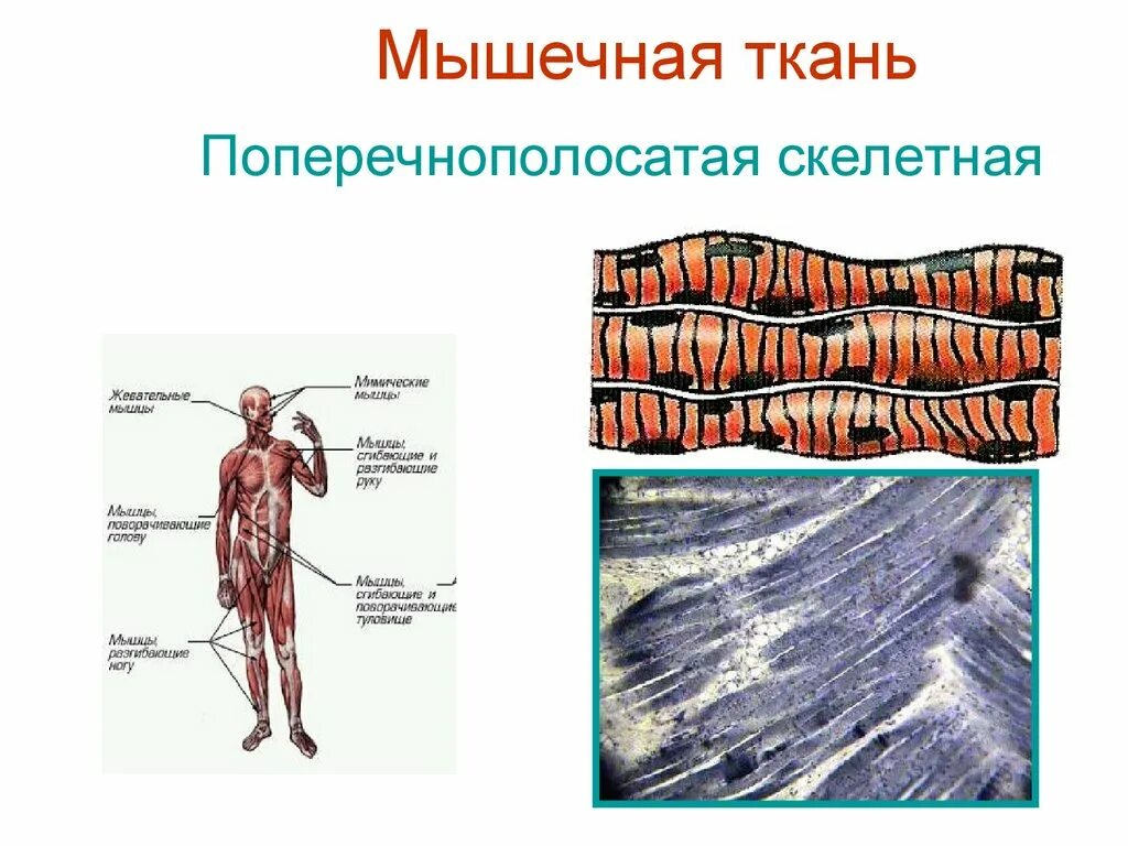 Изображение поперечно полосатой скелетной мышечной ткани. Скелетные поперечнополосатые мышечные ткани. Поперечно полосатая Скелетная ткань. Поперечно полосатая мускулатура. Поперечно полосатая Скелетная мускулатура.