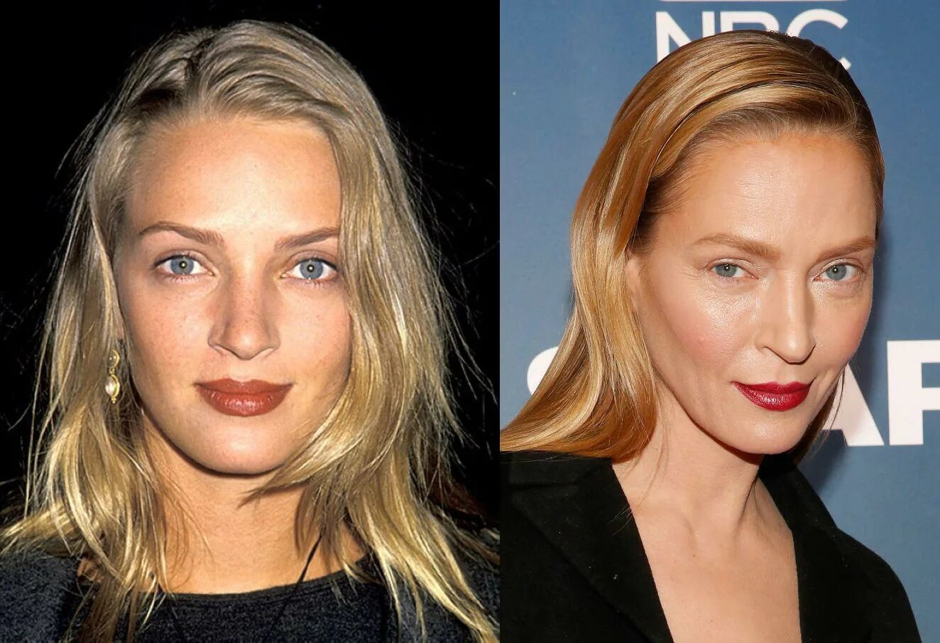 джослин вильденштейн сейчас 2021. ксения собчак ринопластика. юлия волкова тогда и сейчас 2020. звезды сделавшие пластику. эммануэль беар пластика.