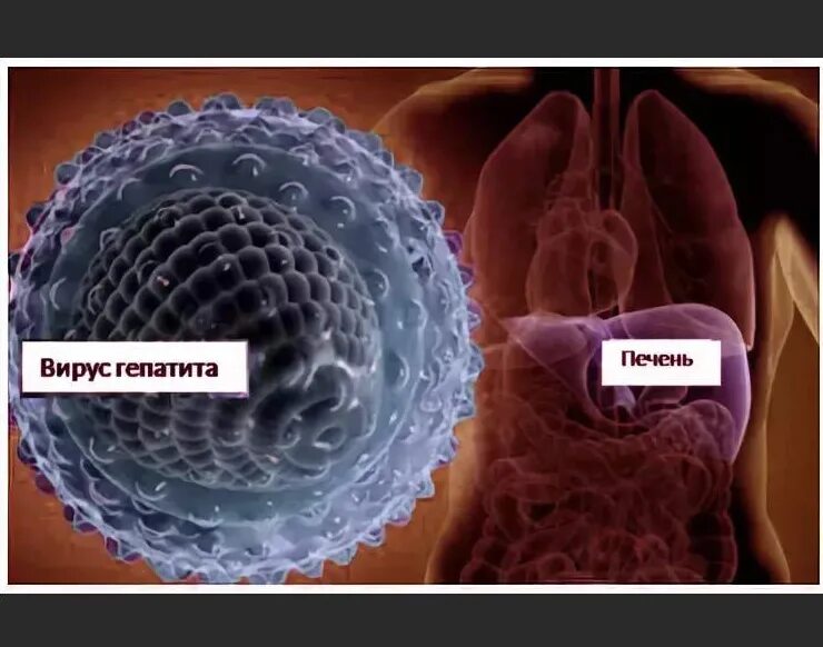 Вирусные гепатиты вызывают. Возбудитель гепатита g. Вирус гепатита g. Вирус гепатита в.