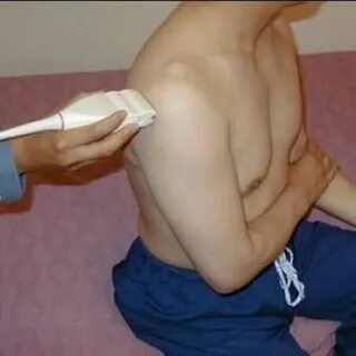 Деформация мышц