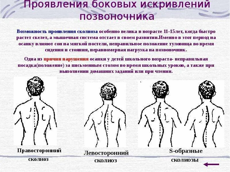 Нарушения и в какую сторону