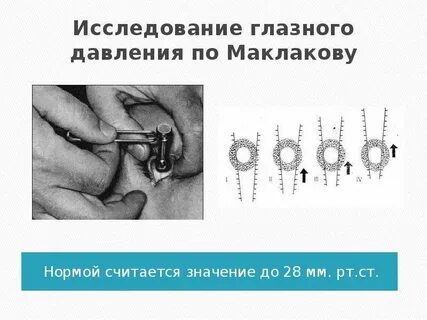 Как измеряют внутриглазное давление у взрослых