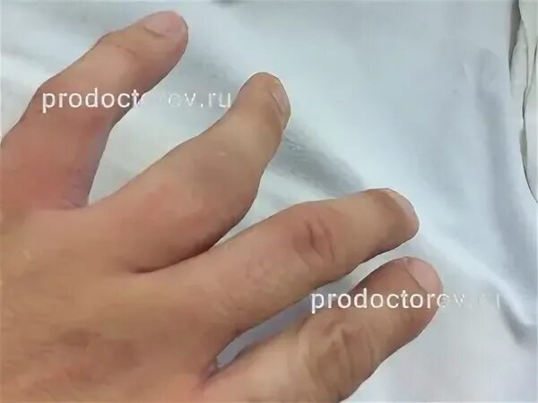 Ответы Mail.ru: Я сломал большой на ноге палец или нет?