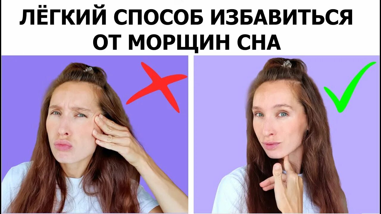 Морщины от сна. Складки на лице после сна. Заломы на лице. Заломы на лице после сна. Коррекция темных кругов.