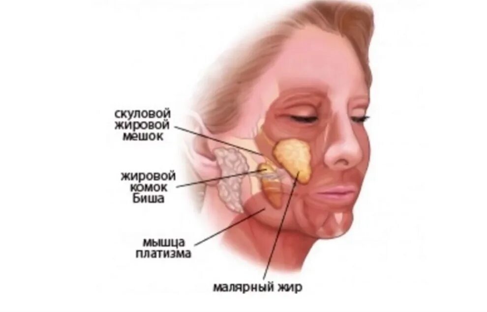 Бишектомия. Жировой комок Биша анатомия. Жировое тело щеки Биша анатомия.