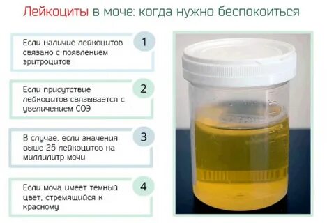 Почему появляются лейкоциты в моче у женщин: какие болезни могут быть? Отвечает 