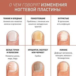 Почему ноготь оранжевый