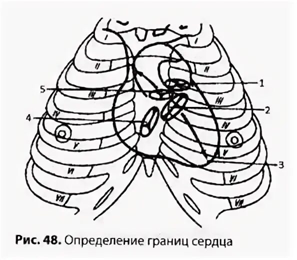 Широких сердец пограничная. Проекция клапанного аппарата сердца на грудную стенку у животных. 2 Межреберье по среднеключичной. Сделайте проекцию клапанного аппарата сердца на грудную стенку у КРС.