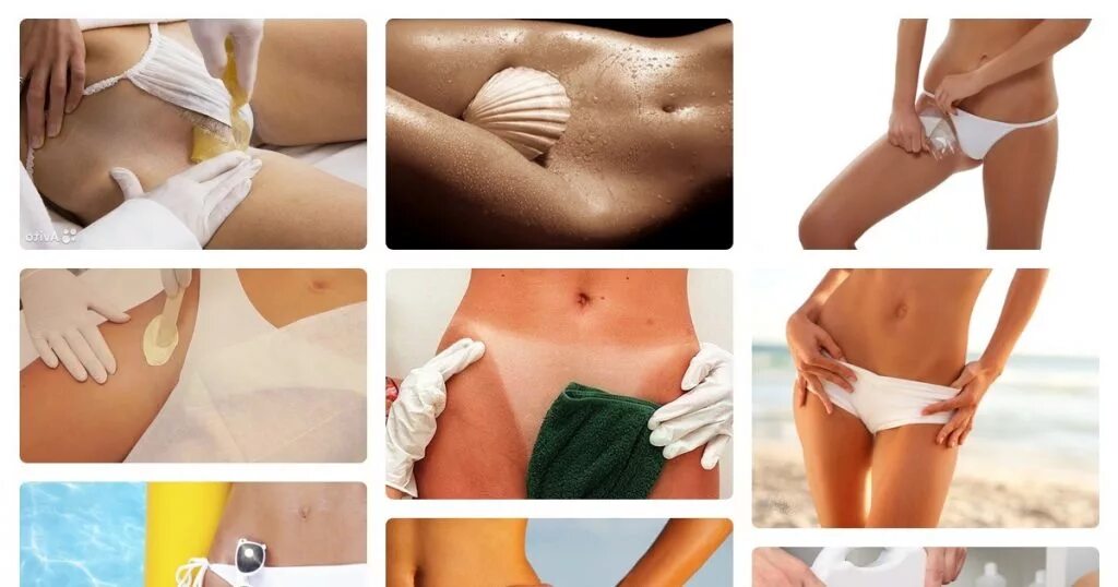 Ваксинг зоны глубокого бикини. Ваксинг глубокого бикини. Фотоэпиляция глубокое бикини. Тотальное бикини лазерная эпиляция. Зона бикини.