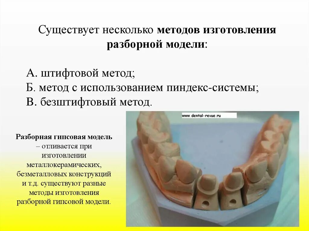 Изготовление разборной модели. Пиндекс система изготовления разборной модели. Изготовление разборной гипсовой модели. Методы изготовления разборных моделей. Метод с использованием пиндекс-системы.