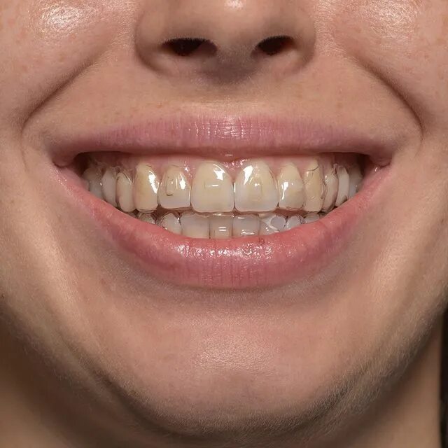 Зубы спб