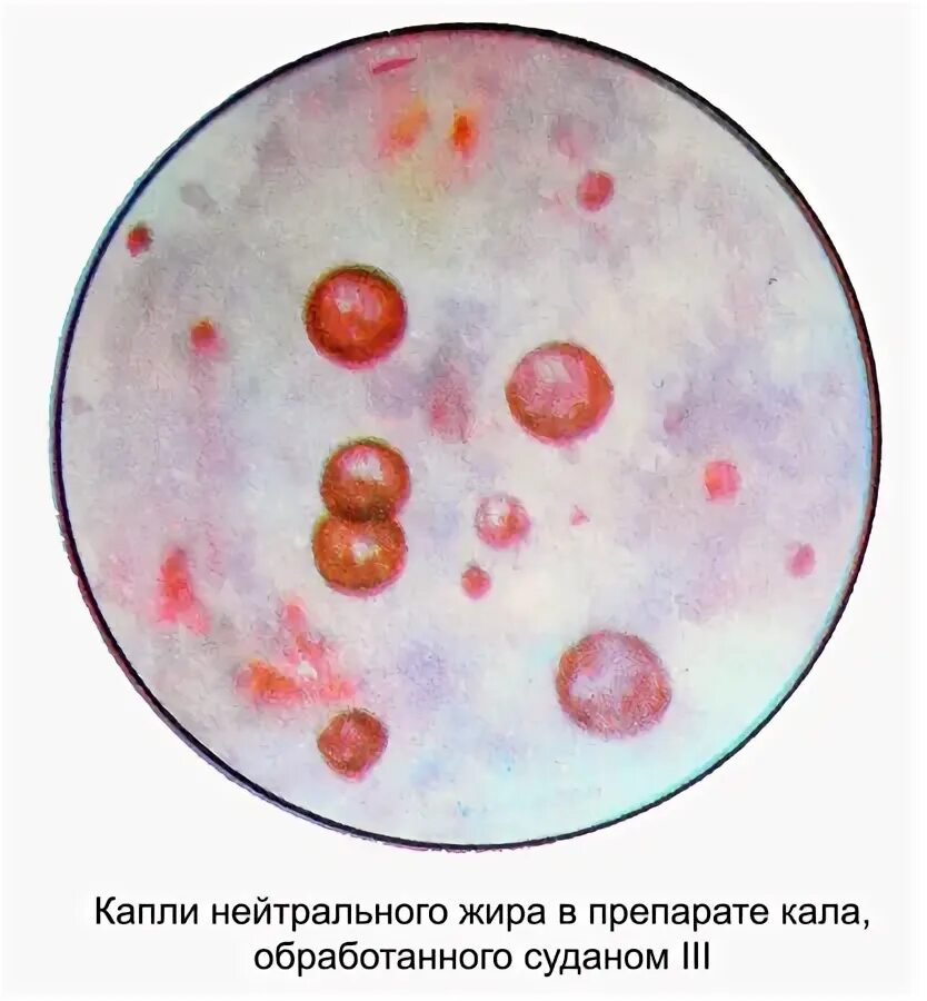 Стеаторея микроскопия кала. Микроскопия кала копрограмма. Копрология микроскопия. Копрограмма макроскопия кала. Грибы в копрограмме у взрослого