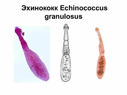 Эхинококк это