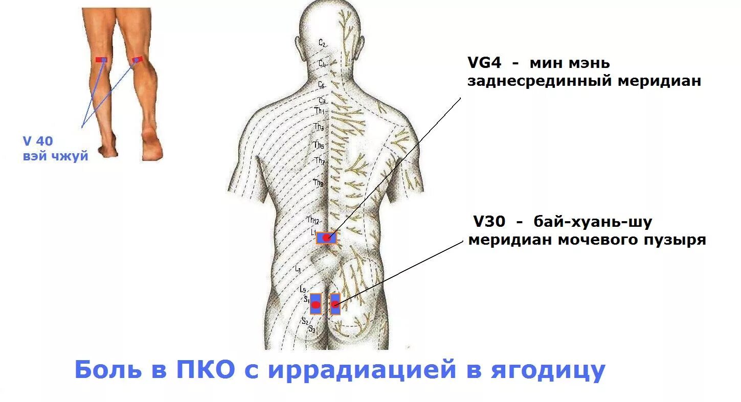 Схема боли в спине. Боль в пояснице. Точки боли в пояснице. Точки при боли в пояснице. Боль в пояснично крестцовой области.