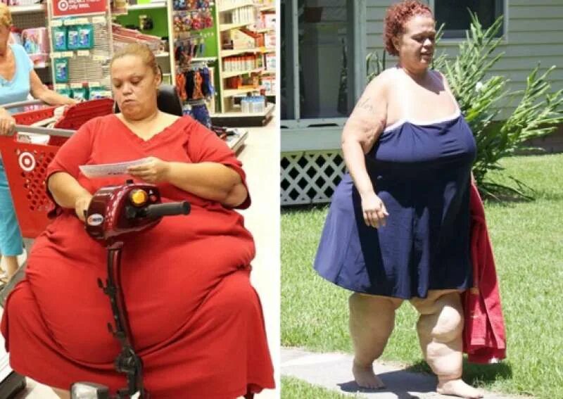 как похудела самая. джло и после похудение. толстые девушки до и после похудения. полные люди до и после. самые толстые люди после похудения.