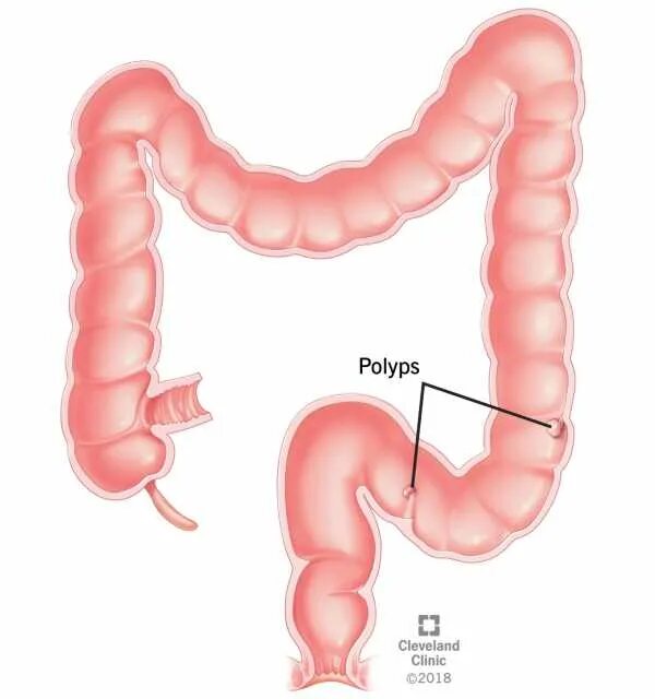 Анатомия толстой кишки и прямой кишки. Строение кишечника и прямой кишки. Толстый кишечник в разрезе. Сигма кишечника