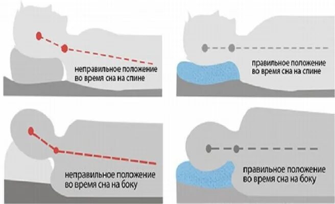 Неправильное положение тела. Правильное положение тела. Неправильное положение спины. Правильное положение позвоночника сидя. Правильное положение во время сна.
