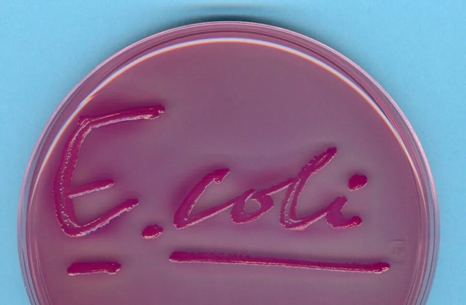 E coli размер. Бактерия escherichia coli. escherichia coli микробиология. escherichia coli эшерихии. штаммы e coli.
