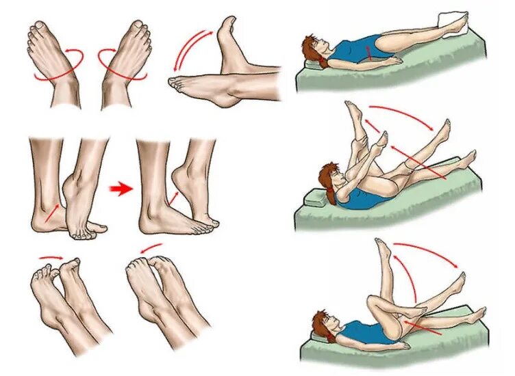 Гимнастика при нейропатии нижних конечностей. Гимнастика для голеностопного сустава после перелома. Гимнастика при полинейропатии нижних конечностей. Гимнастика при тромбозе глубоких вен нижних конечностей. Против судорог в ногах
